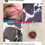 drrikhtegar_1583868472_highlight17847726442926162