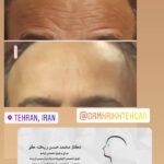 drrikhtegar_1625214789_highlight17847578672484440