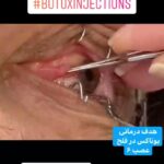 drrikhtegar_1627629189_highlight17847578672484440