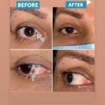 drrikhtegar_1628959459_highlight17847726442926162