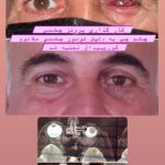 drrikhtegar_1632469182_highlight17847726442926162