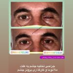 drrikhtegar_1632470117_highlight17847726442926162