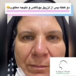 drrikhtegar_1635148138_highlight17847578672484440