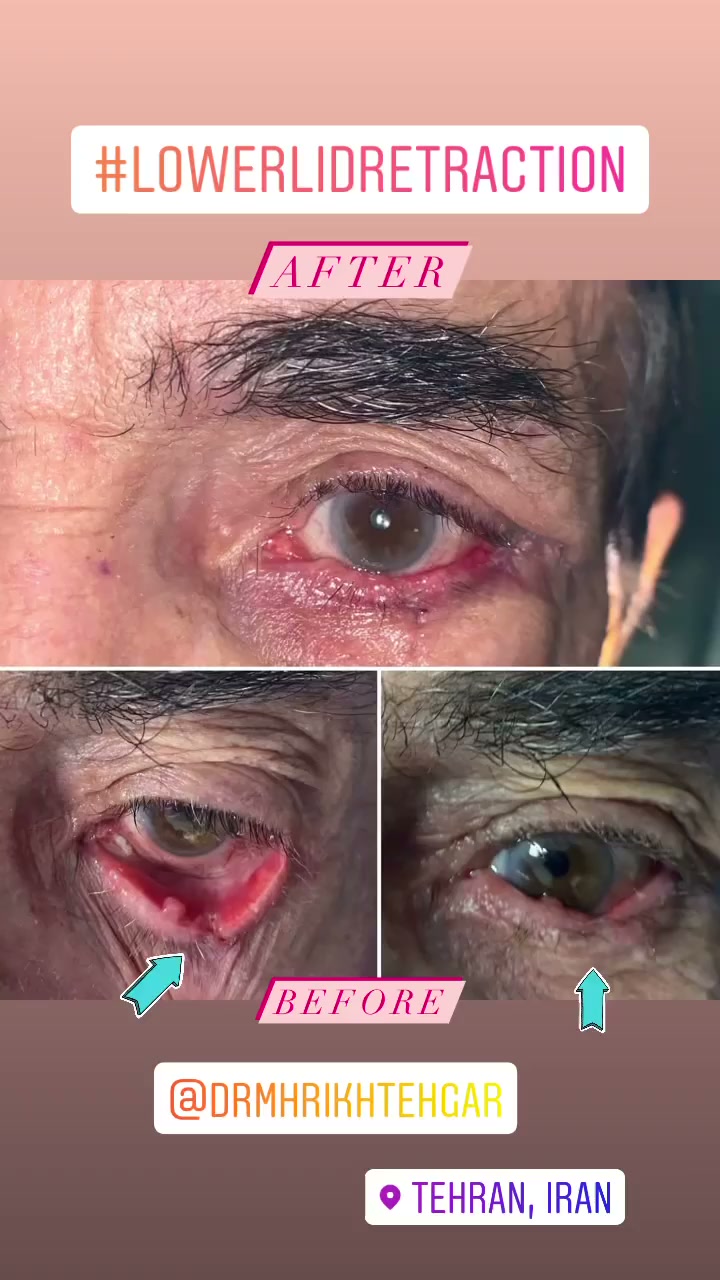 drrikhtegar_1635782013_highlight17847726442926162