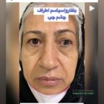 drrikhtegar_1639253832_highlight17847578672484440