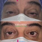 drrikhtegar_1648743206_highlight17956352377678991