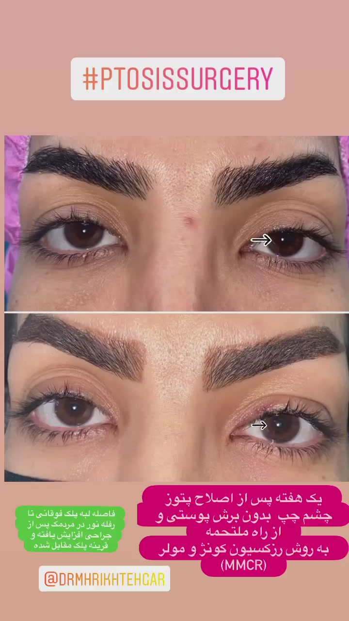 drrikhtegar_1651558112_highlight17956352377678991