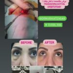 drrikhtegar_1653541204_highlight17847726442926162