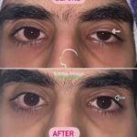 drrikhtegar_1654234323_highlight17956352377678991