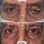 drrikhtegar_1655963051_highlight17956352377678991