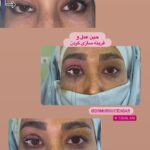 drrikhtegar_1656354932_highlight17956352377678991