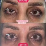 drrikhtegar_1657391184_highlight17956352377678991