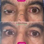 drrikhtegar_1657715786_highlight17956352377678991