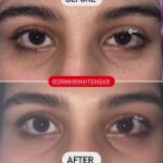 drrikhtegar_1657769288_highlight17956352377678991