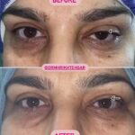 drrikhtegar_1658296682_highlight17956352377678991