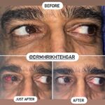 drrikhtegar_1661510520_highlight17972119831707223