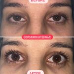 drrikhtegar_1662216179_highlight17956352377678991