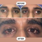 drrikhtegar_1663311474_highlight17972119831707223