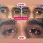 drrikhtegar_1663655704_highlight17972119831707223