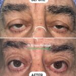 drrikhtegar_1679573567_highlight17956352377678991