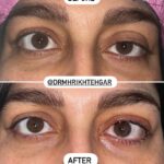 drrikhtegar_1680530393_highlight17956352377678991