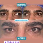 drrikhtegar_1680963429_highlight17972119831707223