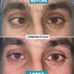 drrikhtegar_1682071594_highlight17972119831707223