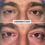 drrikhtegar_1682071876_highlight17956352377678991