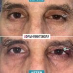 drrikhtegar_1682449918_highlight17956352377678991