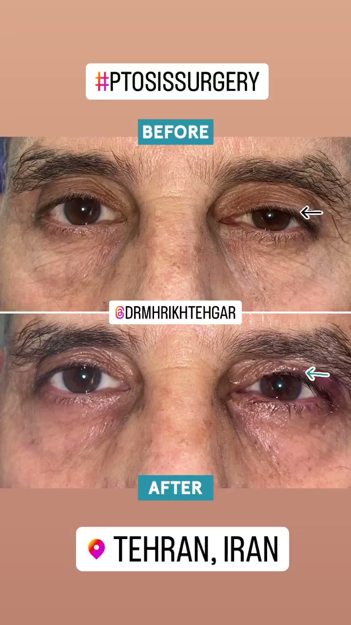 drrikhtegar_1682449918_highlight17956352377678991