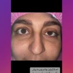 drrikhtegar_1682795947_highlight17956352377678991