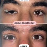 drrikhtegar_1684418681_highlight17956352377678991