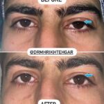 drrikhtegar_1684418897_highlight17956352377678991