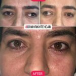 drrikhtegar_1685035679_highlight17972119831707223