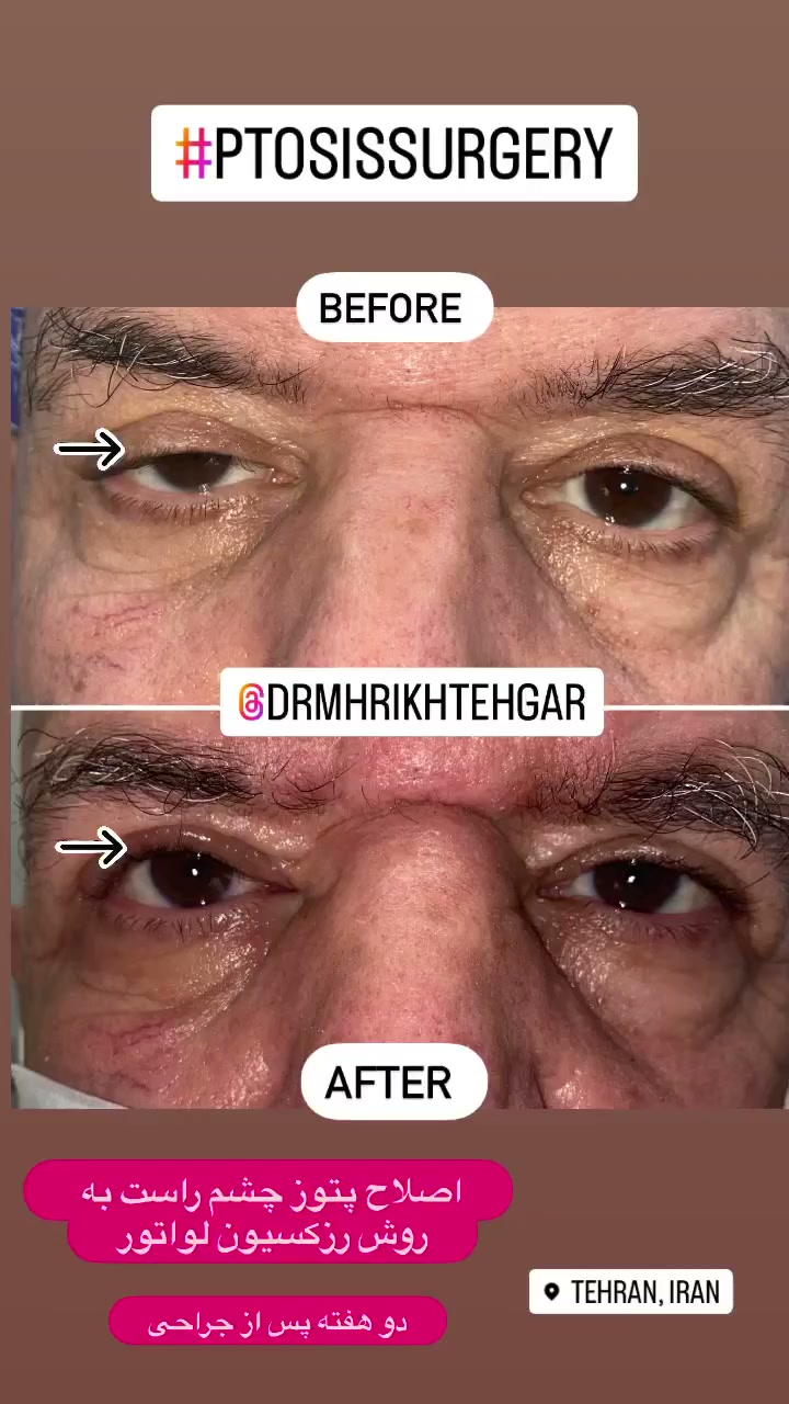 drrikhtegar_1685035927_highlight17956352377678991