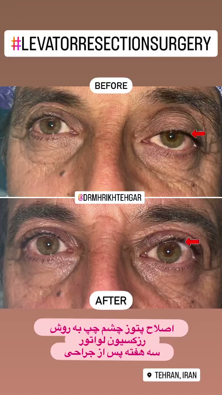 drrikhtegar_1686232832_highlight17956352377678991