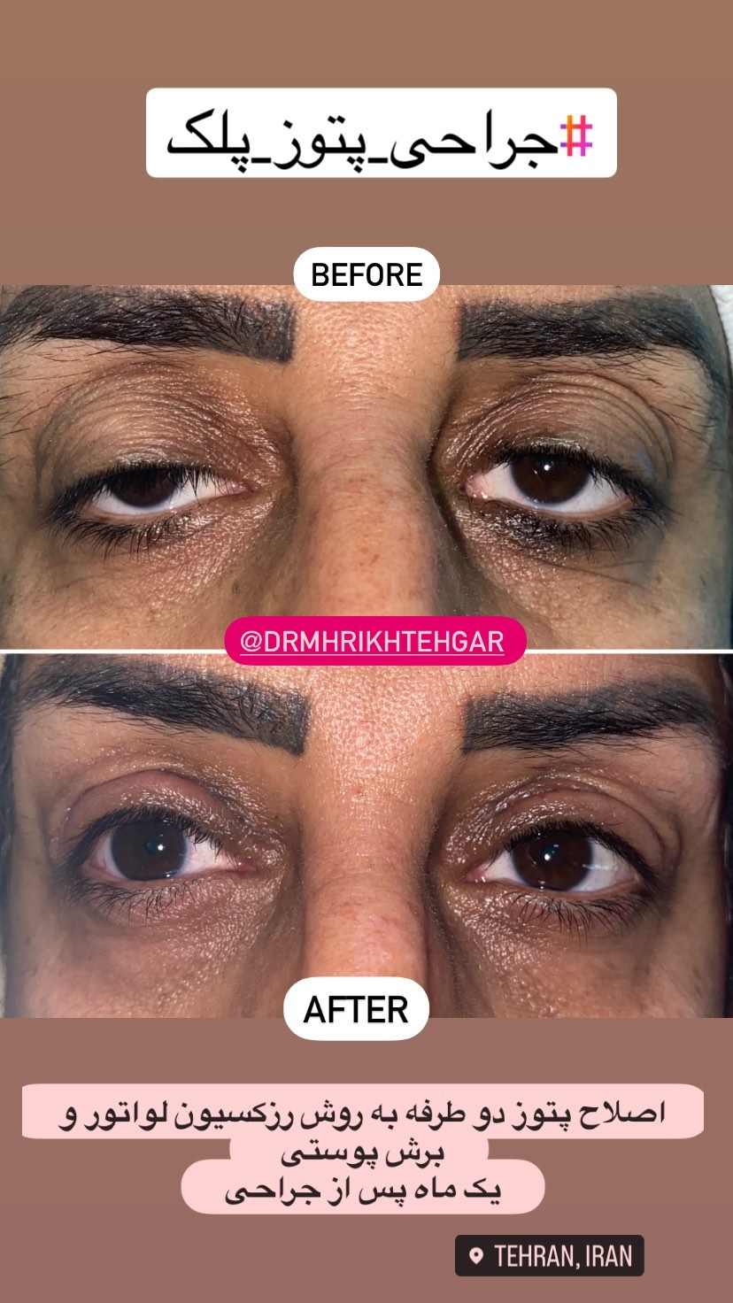 drrikhtegar_1686233015_highlight17956352377678991