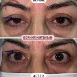 drrikhtegar_1686233228_highlight17956352377678991