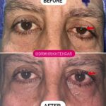 drrikhtegar_1686233691_highlight17956352377678991