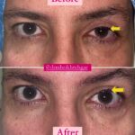 drrikhtegar_1688098639_highlight17956352377678991