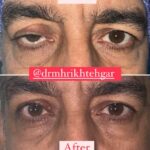 drrikhtegar_1688098879_highlight17956352377678991