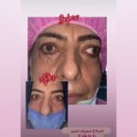 drrikhtegar_1688196036_highlight17972119831707223