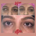 drrikhtegar_1688450128_highlight17972119831707223