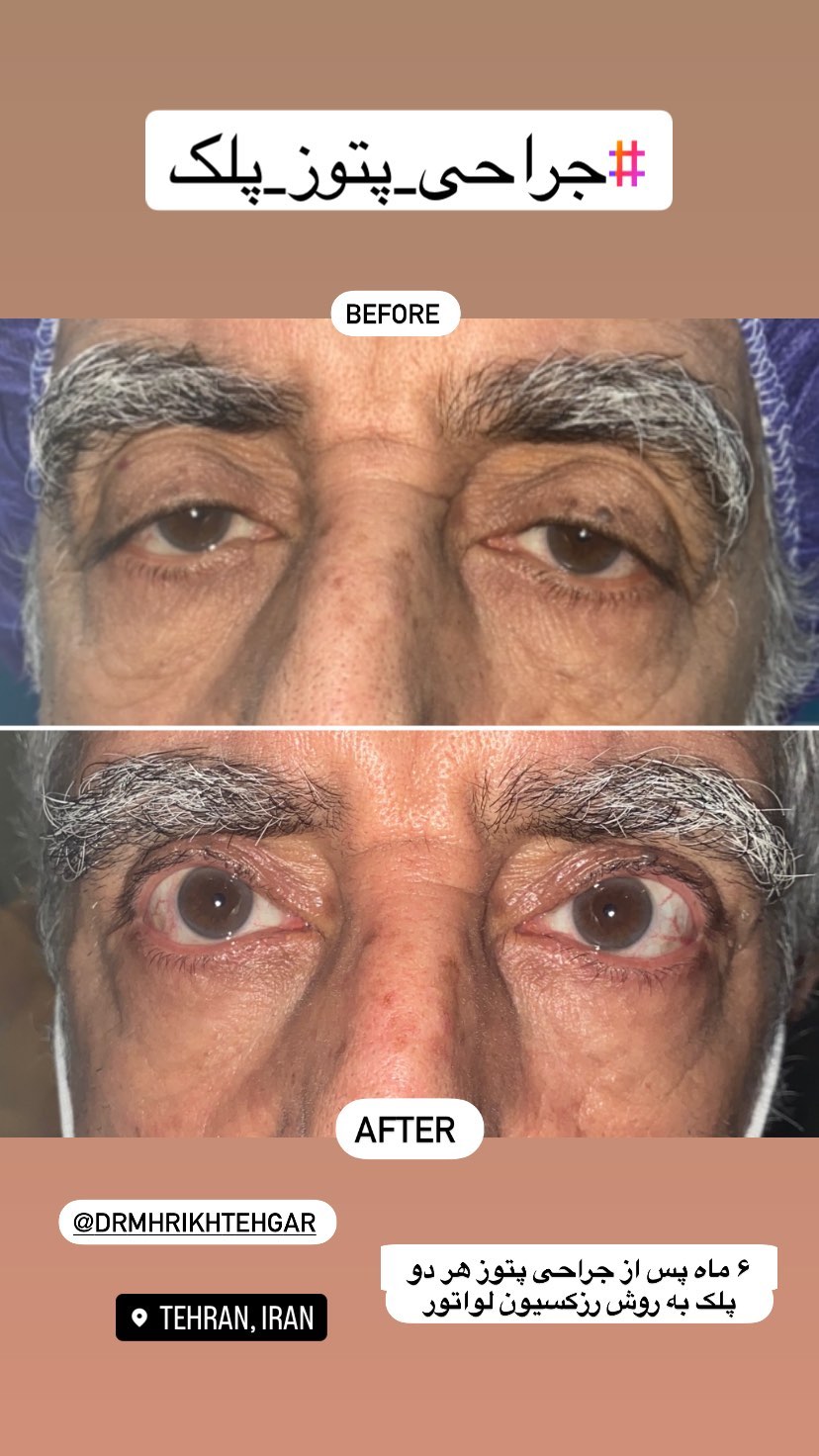 drrikhtegar_1689310883_highlight17956352377678991