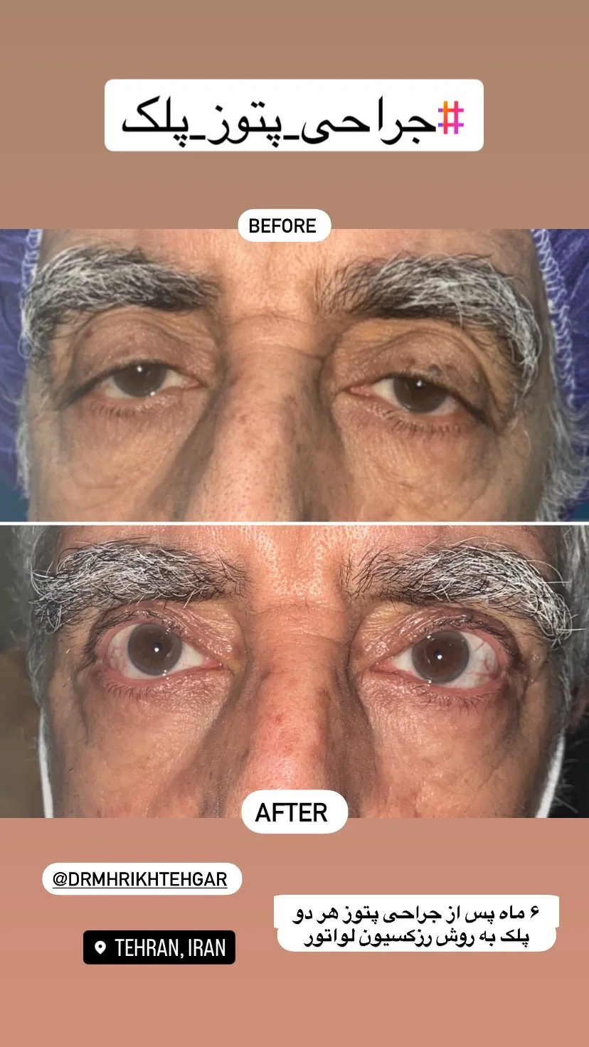 drrikhtegar_1689310883_highlight17956352377678991