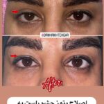 drrikhtegar_1690724299_highlight17956352377678991