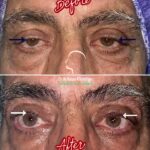 drrikhtegar_1691347437_highlight17956352377678991