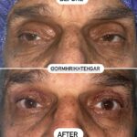 drrikhtegar_1693552931_highlight17956352377678991