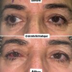 drrikhtegar_1694160689_highlight17972119831707223