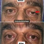 drrikhtegar_1694438913_highlight17956352377678991